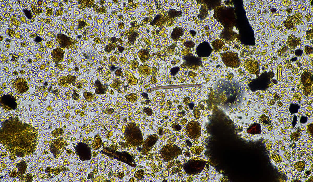 Microscope view of soil microbes